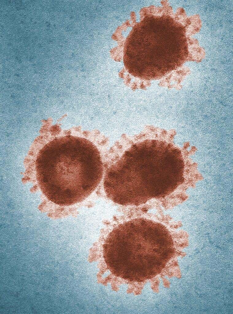 COVID-19 Viren unter dem Mikroskop